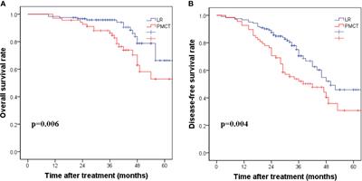 Effect of Severity of Liver Cirrhosis on Surgical Outcomes of Hepatocellular Carcinoma After Liver Resection and Microwave Coagulation